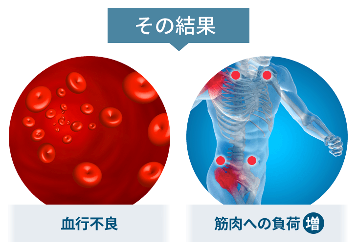 その結果、血行不良や筋肉への負荷の増加が起こります。