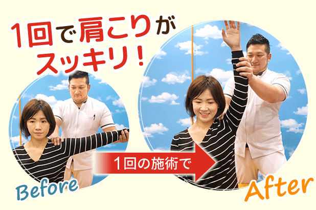 1回の施術で肩の詰まりや肩こりがスッキリ!